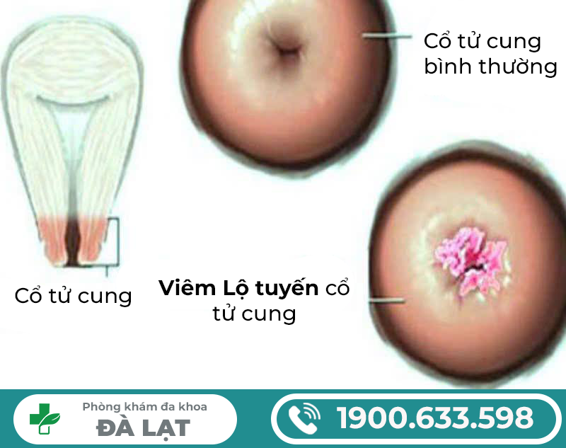 Hình ảnh minh họa